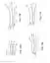 Fig. 44 - Joint Arthroplasty Devices