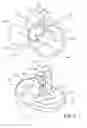 Fig. 02 - Constrained knee prosthesis