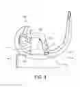 Fig. 04 - Constrained knee prosthesis
