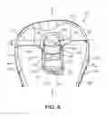 Fig. 06 - Constrained knee prosthesis