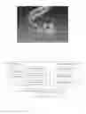 Fig. 09 - Error simulation for image-guided dental implant treatment planning