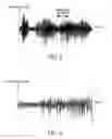 Fig. 04 - Consonant-segment detection apparatus and consonant-segment detection method