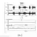Fig. 05 - Consonant-segment detection apparatus and consonant-segment detection method