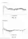 Fig. 10 - Consonant-segment detection apparatus and consonant-segment detection method