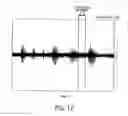 Fig. 11 - Consonant-segment detection apparatus and consonant-segment detection method