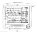 Fig. 02 - System and Method of Automatic Scaling of Clinical Data for Varied Display Size