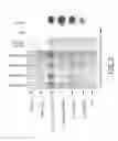 Fig. 10 - Methods and compositions for determining the purity of chemically synthesized nucleic acids