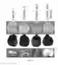 Fig. 08 - Compositions and methods for rapid and efficient production of quality protein maize