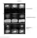 Fig. 15 - Compositions and methods for rapid and efficient production of quality protein maize