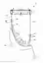 Fig. 01 - Personal lifting device