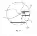 Fig. 05 - Oral care instrument