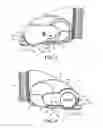 Fig. 04 - Cleaner head