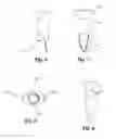 Fig. 05 - Pepper corer set