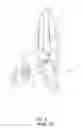 Fig. 10 - Garden shears that avoid loosening of a shaft pin