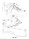 Fig. 29 - Article of footwear with decoupled upper