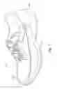 Fig. 02 - THERAPEUTIC SHOE