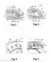 Fig. 03 - Multipoint injection device for a combustion chamber of a turbine engine