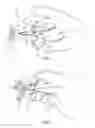 Fig. 02 - Knot loosening device