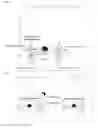 Fig. 11 - Device and method for reducing spread of microorganisms and airborne health hazardous matter and/or for protection from microorganisms and airborne health hazardous matter