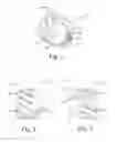 Fig. 02 - Segmenting slug