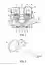 Fig. 02 - Intake valve of internal combustion engine
