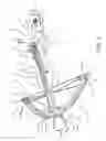 Fig. 02 - Crossbow comprising a composite material component