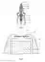 Fig. 02 - DISTRIBUTION HEAD FOR A DEVICE FOR DISTRIBUTING A FLUID PRODUCT