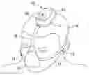 Fig. 01 - Positive airway pressure system with head position control