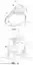Fig. 02 - Positive airway pressure system with head position control