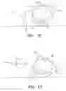 Fig. 11 - Positive airway pressure system with head position control