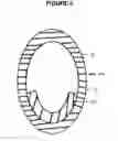 Fig. 07 - HEEL OFFLOADING APPARATUS
