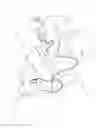 Fig. 02 - Saliva management system with continuous flow through oral device