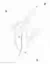 Fig. 01 - VACUUM ASSISTED MOUTHPIECE