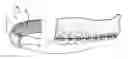 Fig. 01 - Orthodontic appliance shield