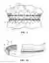 Fig. 02 - Orthodontic appliance shield
