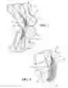 Fig. 05 - Orthodontic appliance shield
