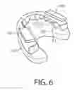 Fig. 05 - Comfortable mouth guard