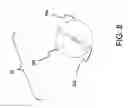 Fig. 09 - Continuous constant-rate feeding system