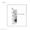 Fig. 02 - Electrophoretic analysis method