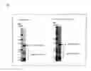 Fig. 05 - Electrophoretic analysis method