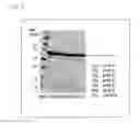 Fig. 10 - Electrophoretic analysis method