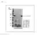 Fig. 11 - Electrophoretic analysis method