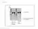 Fig. 12 - Electrophoretic analysis method