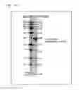 Fig. 19 - Electrophoretic analysis method