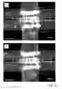 Fig. 16 - Microfluidic system and method for assembling and for subsequently cultivating, and subsequent analysis of complex cell arrangements