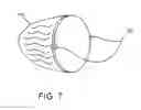 Fig. 07 - Manufacture filtration elements