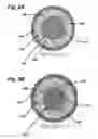 Fig. 07 - Expanding sealing locking systems and methods