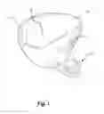 Fig. 02 - Dip clip