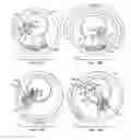 Fig. 09 - Device for singulating and dispensing rigid and semi-rigid strips