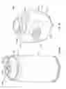 Fig. 08 - Attachment mechanism for a container